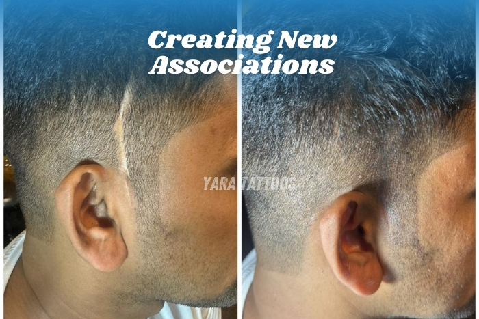 Hairline tattoo covering a visible scar with expert precision Get professional scar concealment and customized tattoos at Yaara Tattoos, Coimbatore