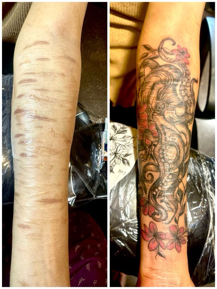 The image shows, before and after tattoo cover-up on a forearm. The left side shows healed scars, while the right displays a detailed octopus and flower tattoo design beautifully concealing them.